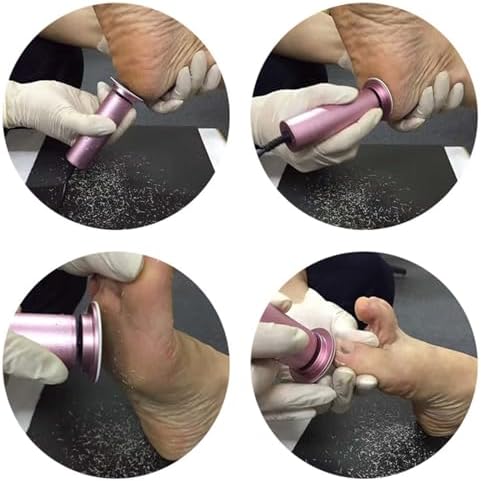 Electric Callus Remover, Ravifun Foot File Grinder Tool with Speed Controller and 60pcs Replacement Sandpaper Disk for Men Women Dead Dry Crack Skin Calluses
