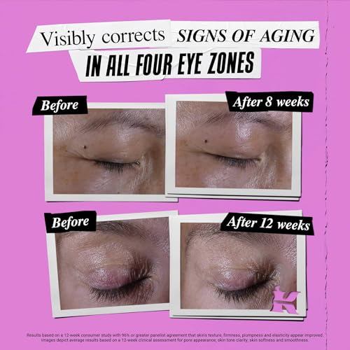 Kiehl's Super Multi-Corrective Eye Cream, Anti-Aging Cream that Lifts Brow Bone Area, Smooths and Firms Eye Lids, Bilberry Seed Extract and Collagen Peptide for Tighter and Smoother Looking Skin