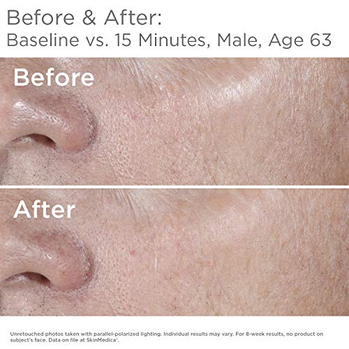 SkinMedica HA5 Rejuvenating Hydrator. Hyaluronic Acid Serum for Face with Five Types of Hyaluronic Acid that Smooth Fine Lines and Wrinkles, For All Skin Types, 1 Oz