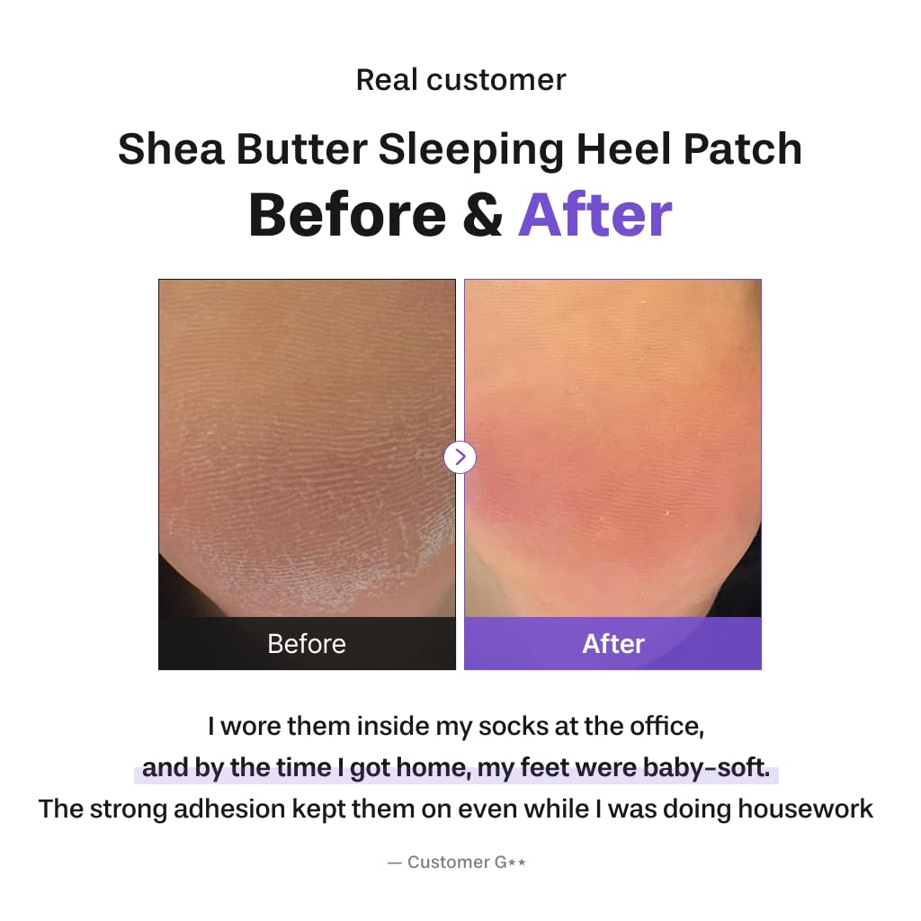 Shea Butter Heel Repair Patch for Cracked Dry Heels, Overnight Foot Moisturizer Mask, Hydrating & Breathable (10pcs), K-Beauty