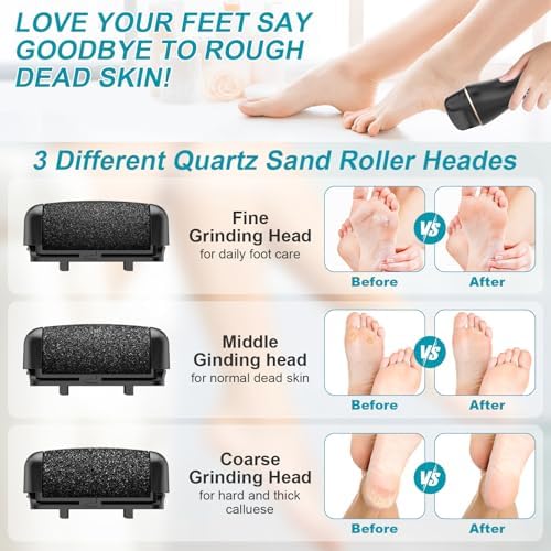 8 Pack Refill Rollers for Electric Foot Callus Remover, Replacement Rollers Heads Foot Care Pedicure Tools, 3 Pack Extra Coarse, 3 Regular Coarse, 2 Gentle Coarse Refill Rollers for Electric Foot File