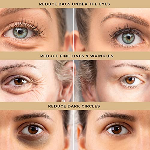 Temporary Eye Tightener Eye Cream for Under-Eye Bags, Dark Circles & Puffiness, Anti Aging Fine Lines, Firm That Delicate Skin Under Your Eyes, 30Ml