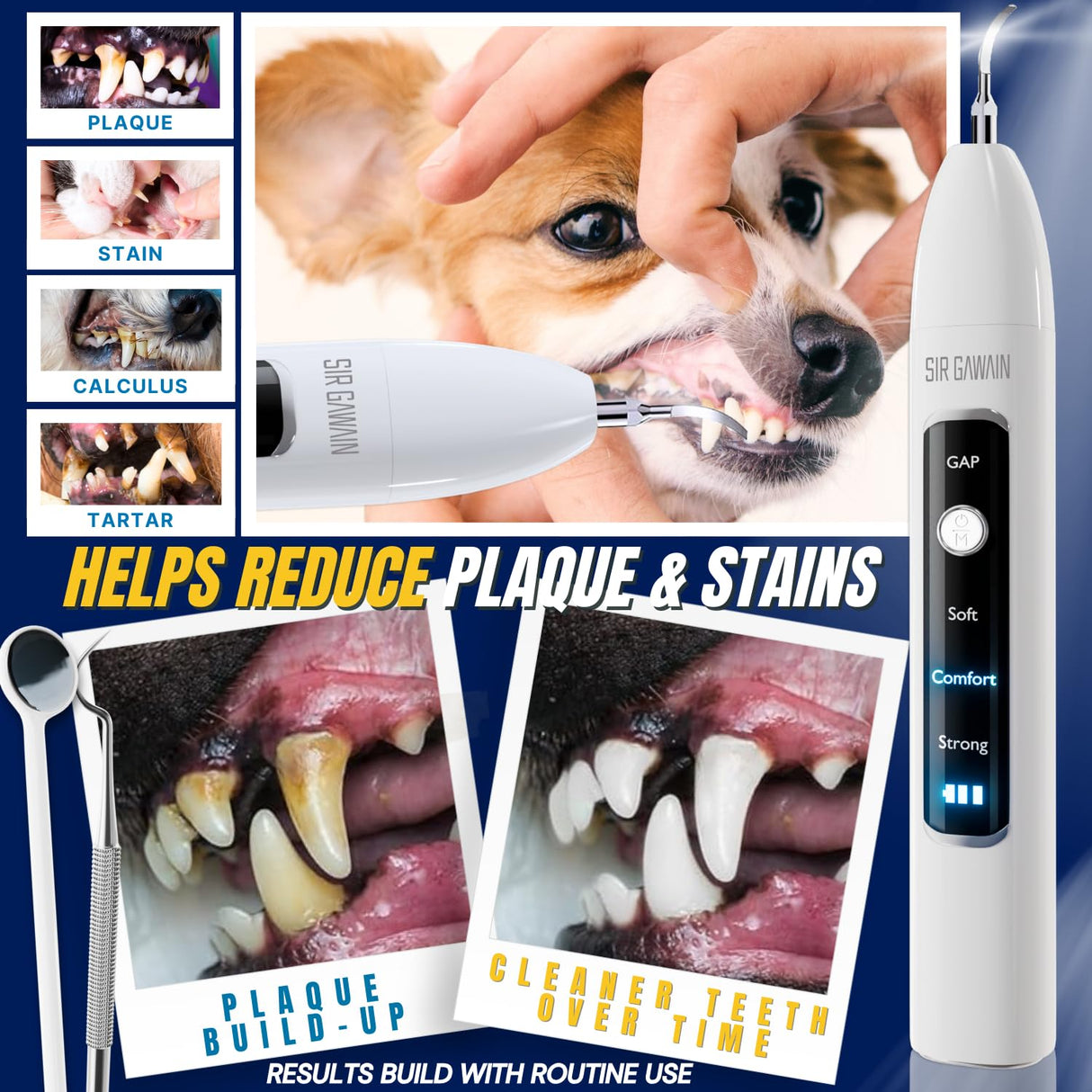 SIRGAWAIN Pet Ultrasonic Dental Cleaner — Plaque, Tartar & Stains Remover, 4 Tips, 3 Modes, LED, Contact-Activated & Smart Touch Protection, Complete Cleaning Kit for Dogs & Cats (White)