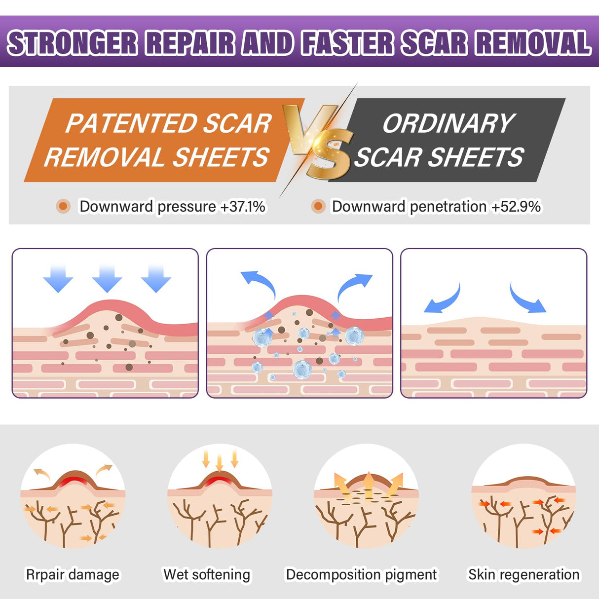 Silicone Scar Sheets, Medical Grade Silicone Scar Tape for Surgical, Hypertrophic, Keloid, C-Section, Burn, Old & New Scars, Reusable Professional Scars Removal Sheets (1.6"X 59" Roll-1.5M)