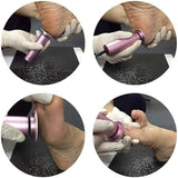 Electric Callus Remover, Ravifun Foot File Grinder Tool with Speed Controller and 60pcs Replacement Sandpaper Disk for Men Women Dead Dry Crack Skin Calluses