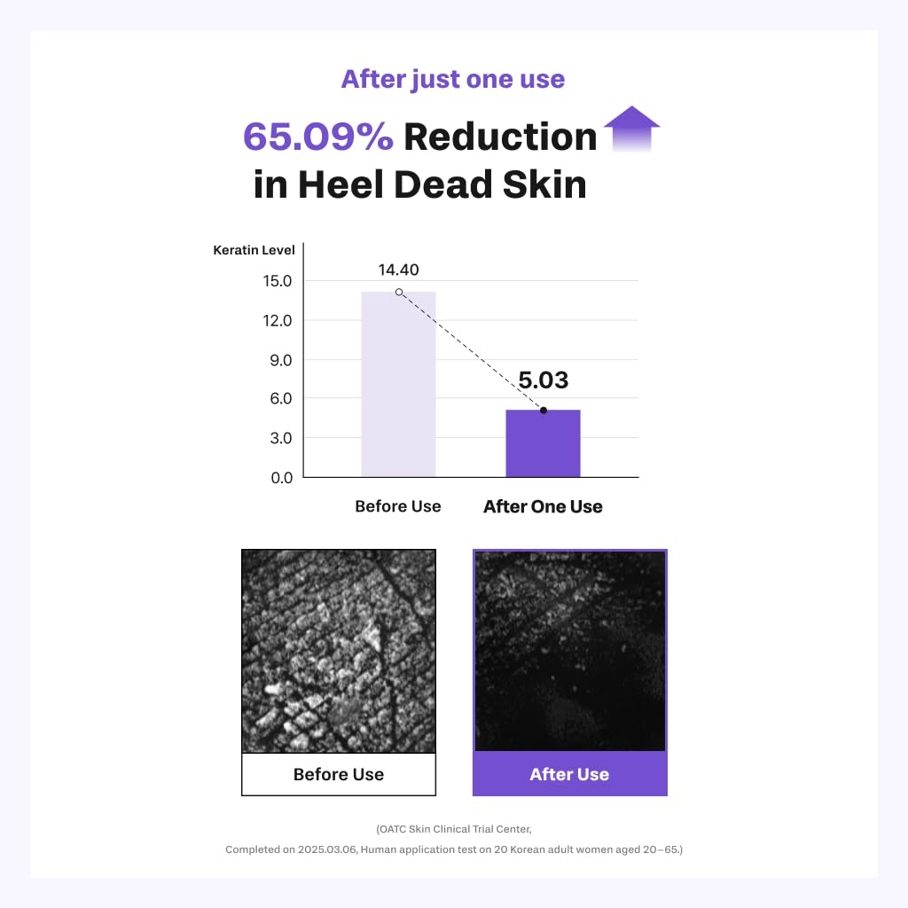 Shea Butter Heel Repair Patch for Cracked Dry Heels, Overnight Foot Moisturizer Mask, Hydrating & Breathable (10pcs), K-Beauty