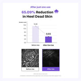 Shea Butter Heel Repair Patch for Cracked Dry Heels, Overnight Foot Moisturizer Mask, Hydrating & Breathable (10pcs), K-Beauty