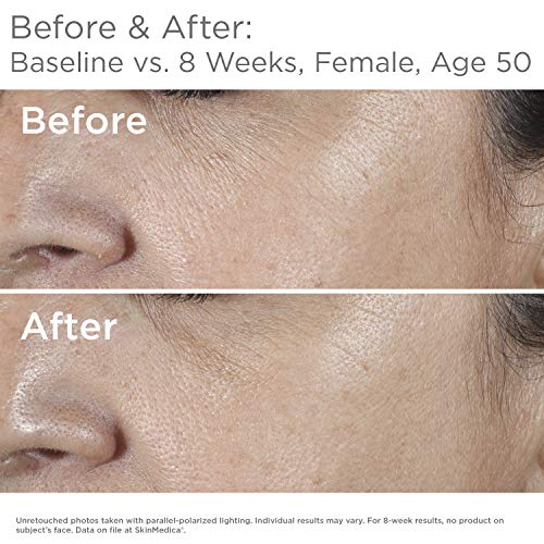 SkinMedica HA5 Rejuvenating Hydrator. Hyaluronic Acid Serum for Face with Five Types of Hyaluronic Acid that Smooth Fine Lines and Wrinkles, For All Skin Types, 1 Oz