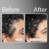 Act+Acre 3-Pack Mini Cold Processed Stem Cell Scalp Serum - Promotes Thicker and Fuller-Looking Hair - Soothes and Hydrates the Scalp - Sulphate and Paraben Free - Aloe Vera for Improved Scalp Health.