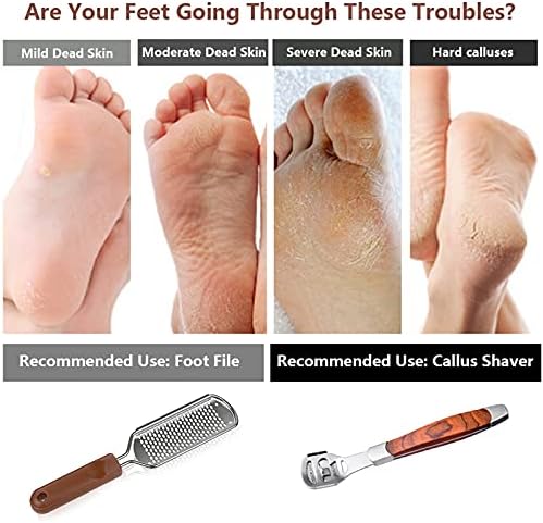 Colossal Foot Rasp & Wood Handle Callus Shaver (10 Replacement & 1 Foot File Heads), Pedicure Foot File Kit, Heel Scraper for Feet, Foot File Callus Remover