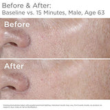 SkinMedica HA5 Rejuvenating Hydrator. Hyaluronic Acid Serum for Face with Five Types of Hyaluronic Acid that Smooth Fine Lines and Wrinkles, For All Skin Types, 1 Oz
