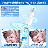 Dog Plaque Remover for Teeth，Pet Ultrasonic Tooth Cleaner，Teeth Cleaning Kit -Tartar Remover for Teeth Stains for Dogs and Cats (White)