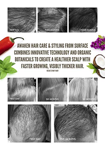 Surface Hair Healthy Scalp and Hair Thickening Shampoo - Proven Hydrating Shampoos for Women and Men - Organic Scalp Cleanser that Restores and Revitalizes, Treatment for Thinning Hair