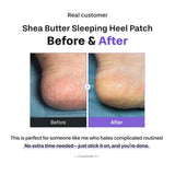 Shea Butter Heel Repair Patch for Cracked Dry Heels, Overnight Foot Moisturizer Mask, Hydrating & Breathable (10pcs), K-Beauty