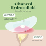 Absorbing Cover Healing Invisible Acne Patch Blemish Spot, Treatment, Facial Acne Patch Vegan, Cruelty Free, Hydrocolloid, Two Sizes 10mm 12mm (Total 84 Counts)