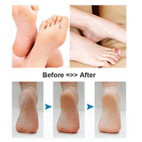 Foot Scrubber Electric Callus Remover Rechargeable Foot File Hard Skin Remover Pedicure Tools Electronic Callus kit for Cracked Heels and Dead Skin with 2 Roller Heads, Blue