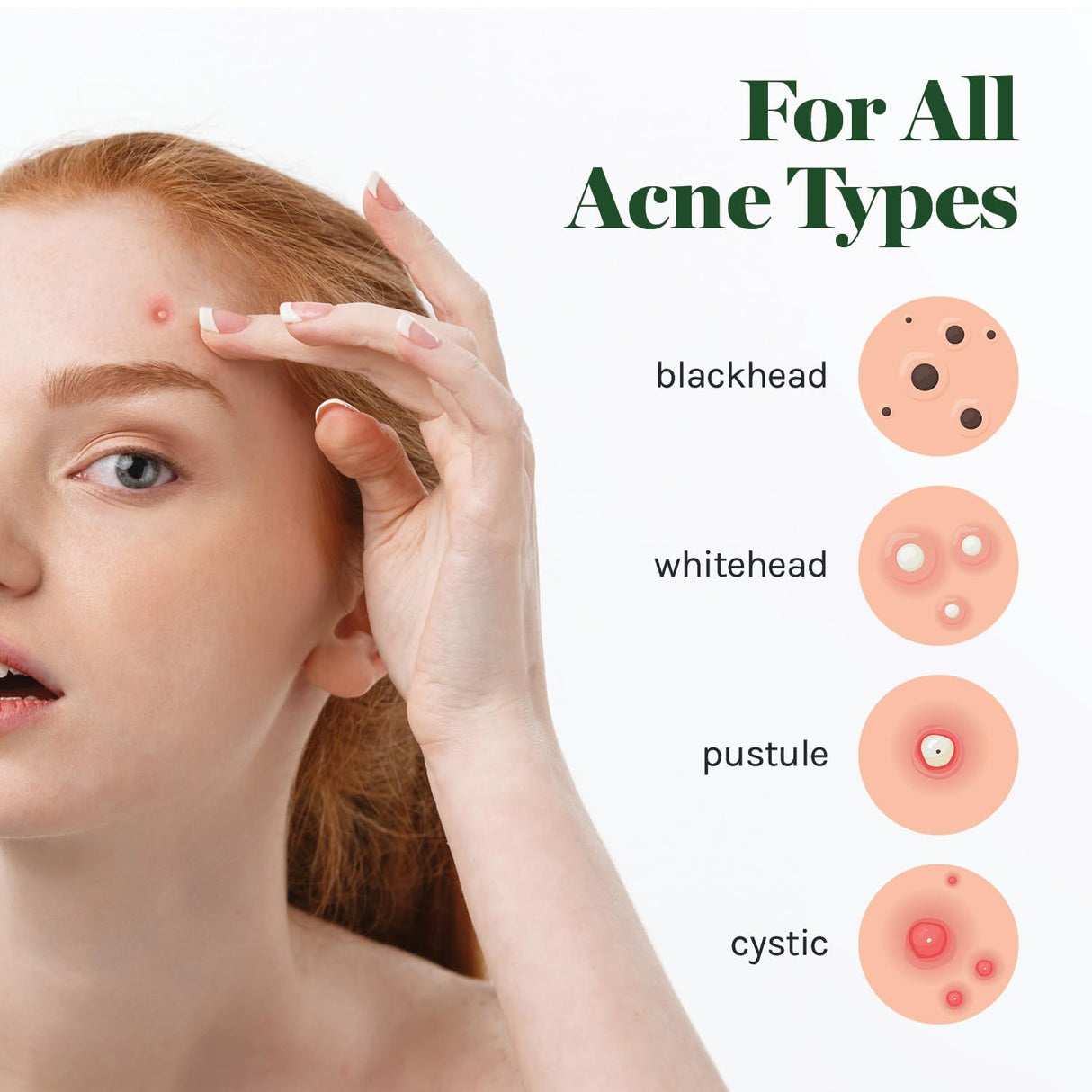 Absorbing Cover Healing Invisible Acne Patch Blemish Spot, Treatment, Facial Acne Patch Vegan, Cruelty Free, Hydrocolloid, Two Sizes 10mm 12mm (Total 84 Counts)