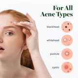 Absorbing Cover Healing Invisible Acne Patch Blemish Spot, Treatment, Facial Acne Patch Vegan, Cruelty Free, Hydrocolloid, Two Sizes 10mm 12mm (Total 84 Counts)