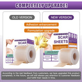 Silicone Scar Sheets, Medical Grade Silicone Scar Tape for Surgical, Hypertrophic, Keloid, C-Section, Burn, Old & New Scars, Reusable Professional Scars Removal Sheets (1.6"X 59" Roll-1.5M)