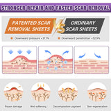 Silicone Scar Sheets, Medical Grade Silicone Scar Tape for Surgical, Hypertrophic, Keloid, C-Section, Burn, Old & New Scars, Reusable Professional Scars Removal Sheets (1.6"X 59" Roll-1.5M)