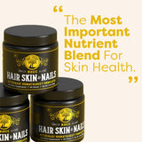 Medical-Strength Hair Skin & Nails Dog Chews | Vitamin A Retinol & B3 Niacinamide for Dogs | EPA Omega 3 for Dog | Relieve Itching, Flaky Skin & Brittle Nails | 90 Chews