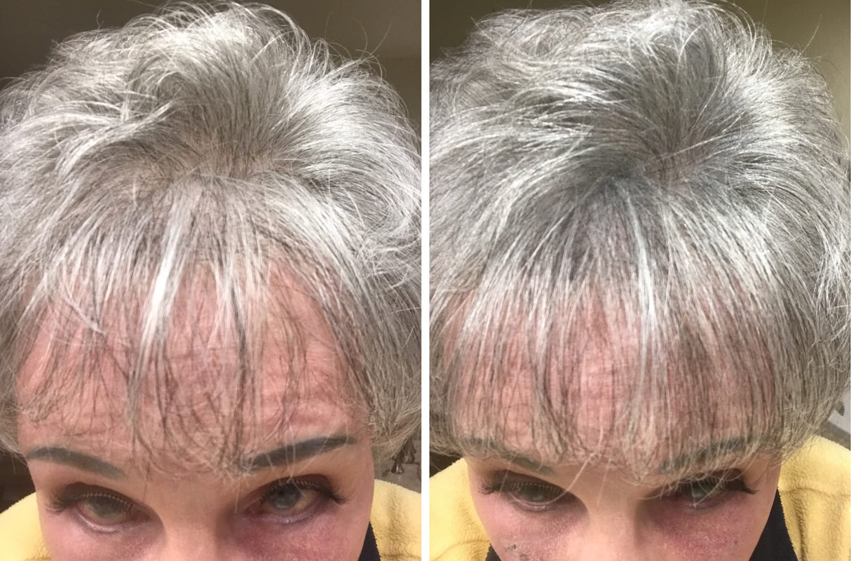 Caboki Hair Loss Concealer. All-Natural Hair Building Fiber. Make Thin Hair Look 10X Fuller Instantly. Eliminate The Appearance of Bald Spot and Thinning Hair (30G, 90-Day Supply). Gray