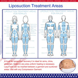 KUSMOO 5 Pack Lipo Foam Pads for Post Surgery Ab Board Liposuction Surgery Flattening Abdominal Compression Garments Lipo Foam Sheets 8" x 11"